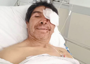 Montesino, alta y recuperación en tiempo récord