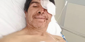 Montesino, alta y recuperación en tiempo récord